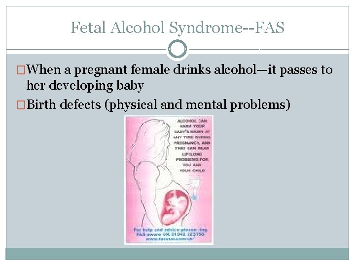 Fetal Alcohol Syndrome--FAS �When a pregnant female drinks alcohol—it passes to her developing baby