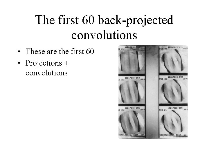 The first 60 back-projected convolutions • These are the first 60 • Projections +