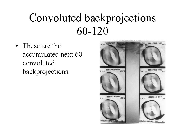 Convoluted backprojections 60 -120 • These are the accumulated next 60 convoluted backprojections. 