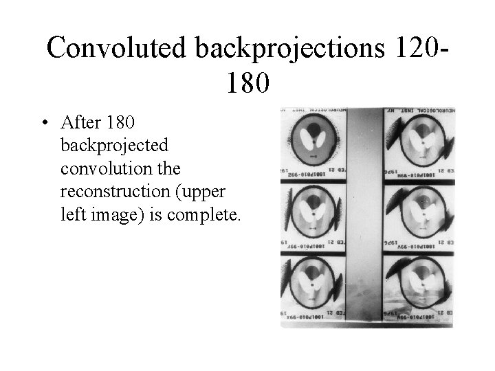 Convoluted backprojections 120180 • After 180 backprojected convolution the reconstruction (upper left image) is