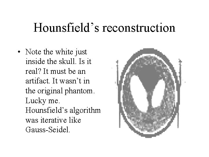 Hounsfield’s reconstruction • Note the white just inside the skull. Is it real? It