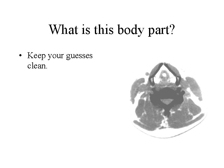 What is this body part? • Keep your guesses clean. 