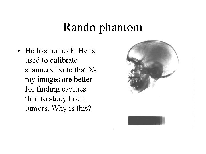 Rando phantom • He has no neck. He is used to calibrate scanners. Note