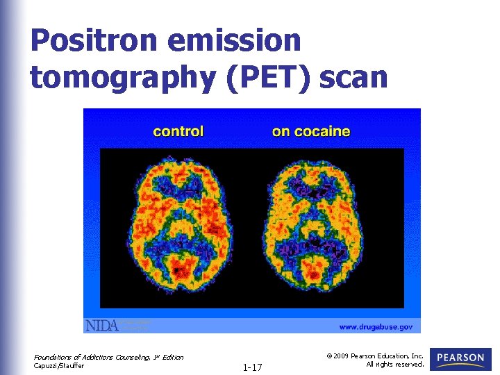 Positron emission tomography (PET) scan Foundations of Addictions Counseling, 1 st Edition Capuzzi/Stauffer 1