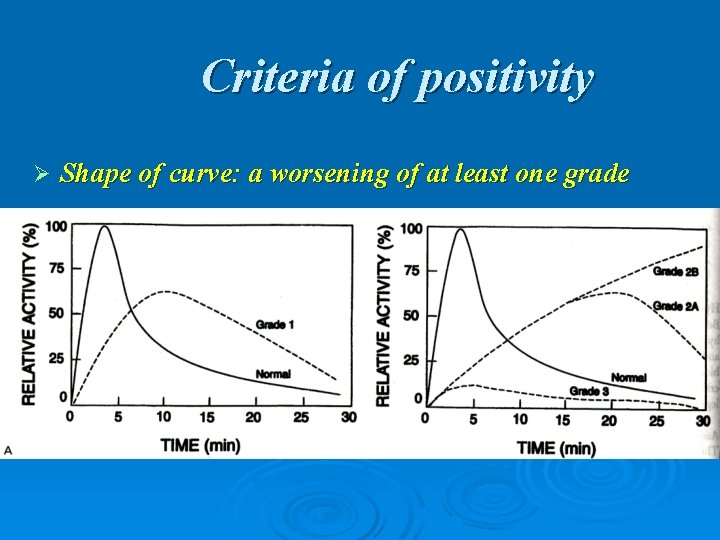 Criteria of positivity Ø Shape of curve: a worsening of at least one grade