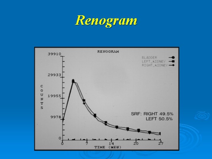 Renogram 