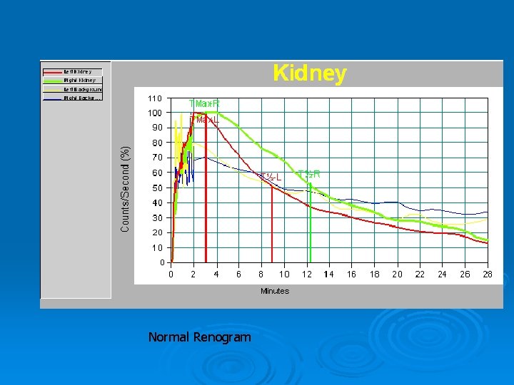 Normal Renogram 