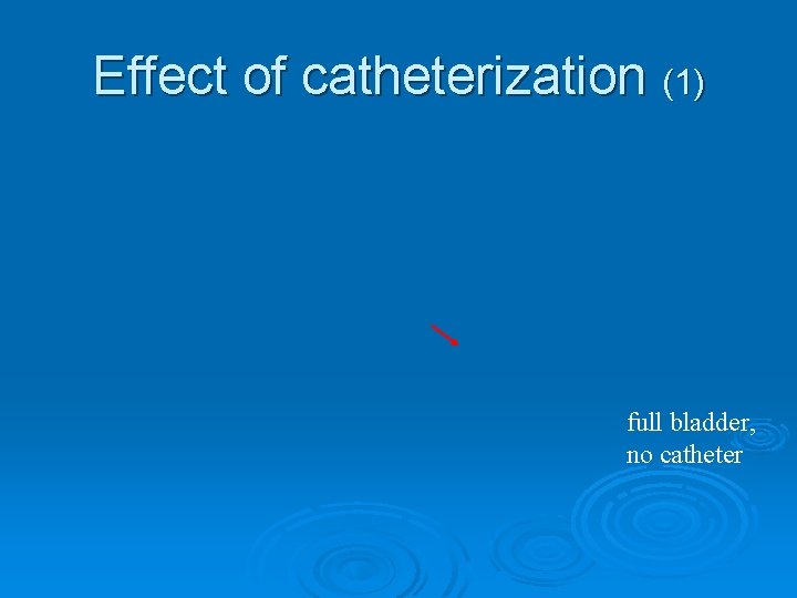 Effect of catheterization (1) full bladder, no catheter 