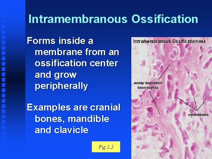 Intramembranous Ossification Forms inside a membrane from an ossification center and grow peripherally Examples