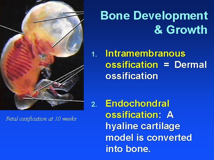 Bone Development & Growth Fetal ossification at 10 weeks 1. Intramembranous ossification = Dermal