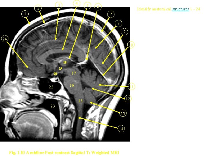 4 3 2 5 1 6 Identify anatomical structures 1 - 24 7 8