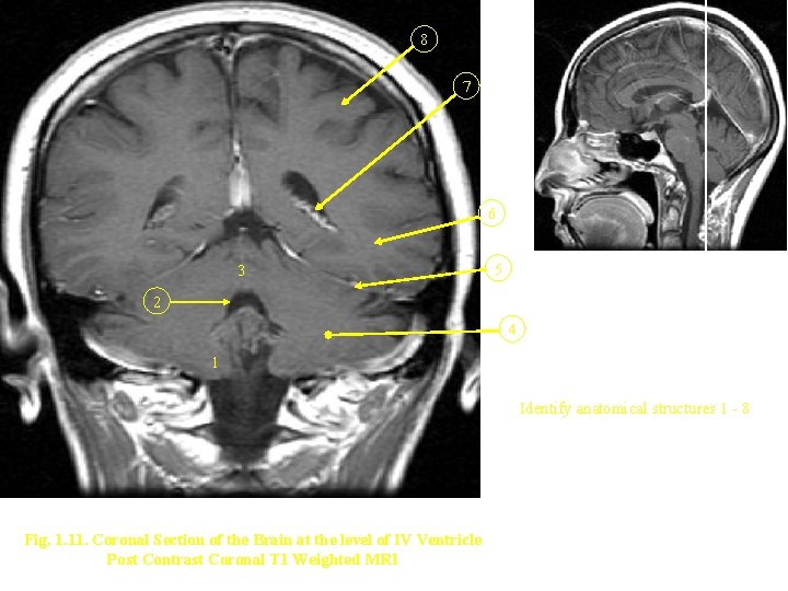 8 7 6 3 5 2 4 1 Identify anatomical structures 1 - 8