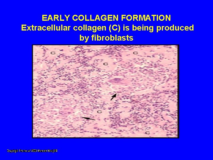 EARLY COLLAGEN FORMATION Extracellular collagen (C) is being produced by fibroblasts EARLY COLLAGEN FORMATION Extracellular collagen (C) is being produced by fibroblasts