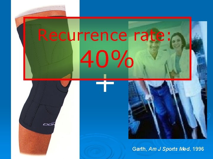 Recurrence rate: 40% + Garth, Am J Sports Med, 1996 