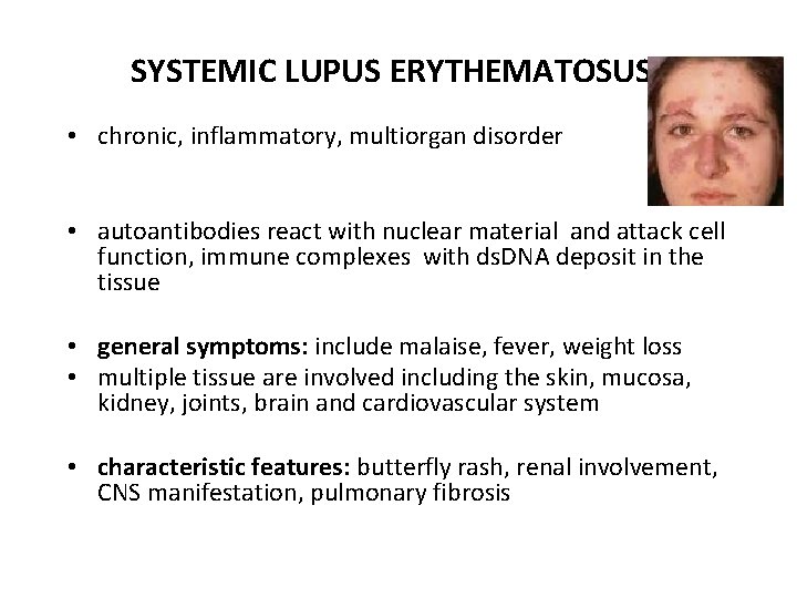 SYSTEMIC LUPUS ERYTHEMATOSUS • chronic, inflammatory, multiorgan disorder • autoantibodies react with nuclear material