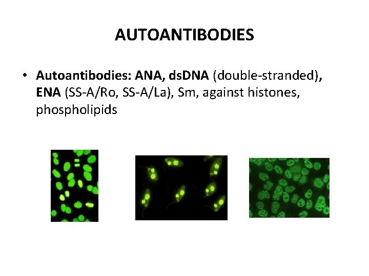 AUTOANTIBODIES • Autoantibodies: ANA, ds. DNA (double-stranded), ENA (SS-A/Ro, SS-A/La), Sm, against histones, phospholipids