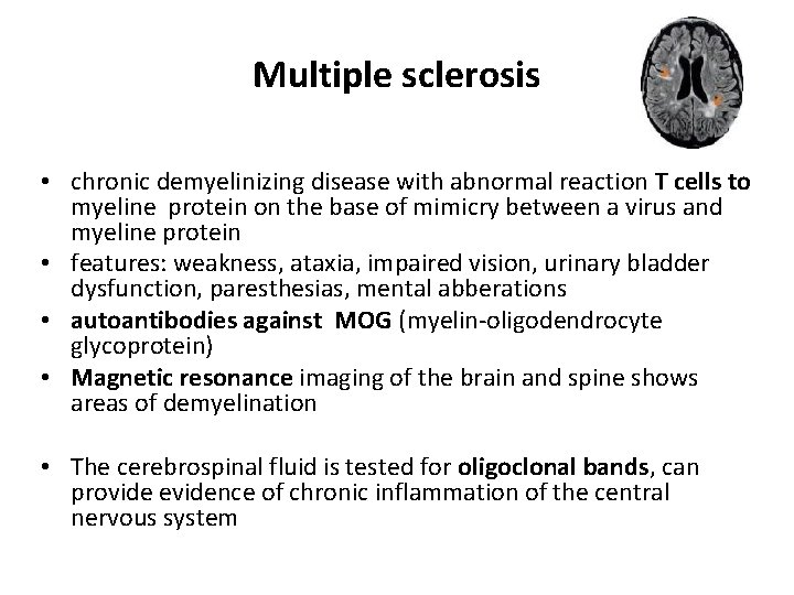 Multiple sclerosis • chronic demyelinizing disease with abnormal reaction T cells to myeline protein