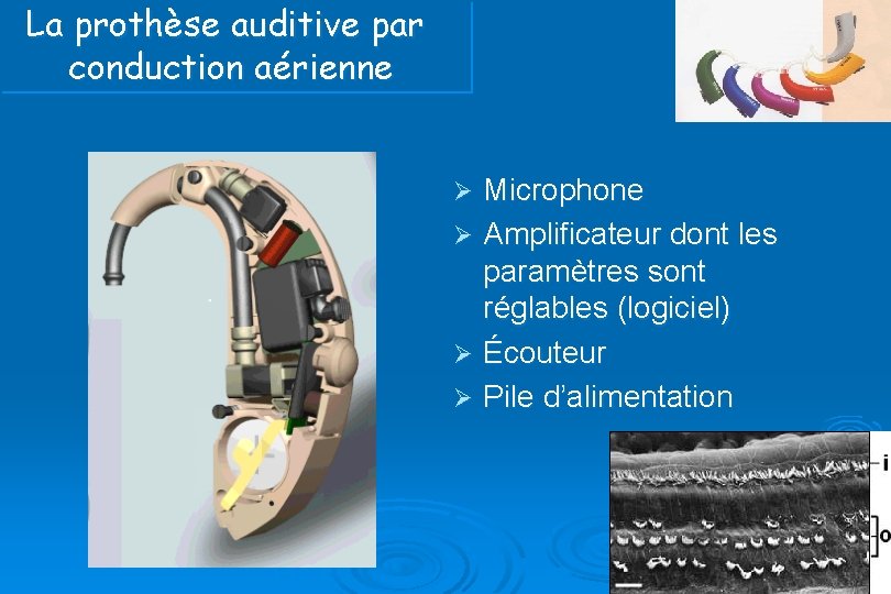 La prothèse auditive par conduction aérienne Microphone Ø Amplificateur dont les paramètres sont réglables