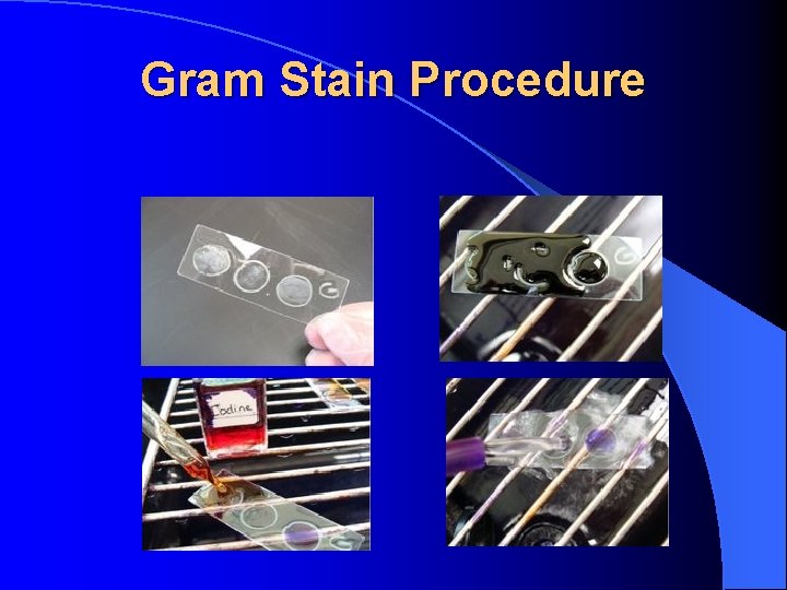 Gram Stain Procedure 