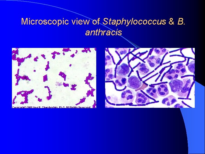 Microscopic view of Staphylococcus & B. anthracis 