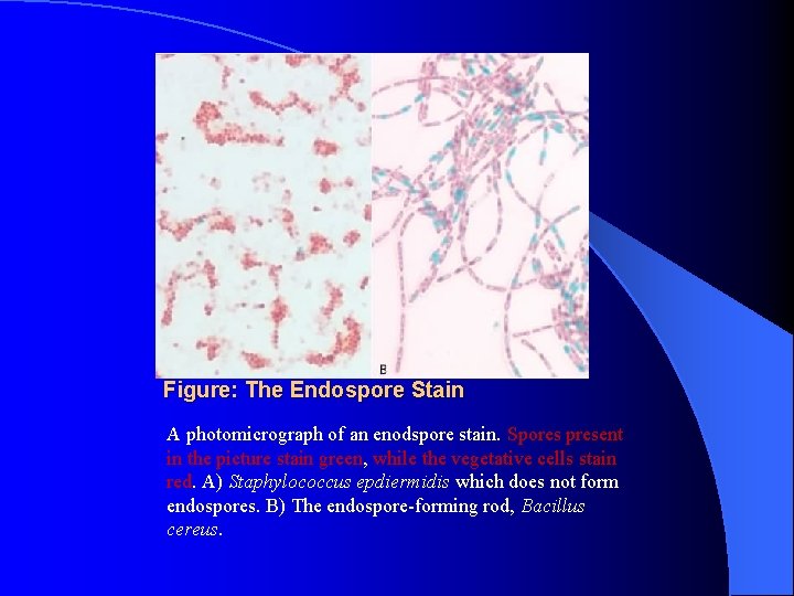Figure: The Endospore Stain A photomicrograph of an enodspore stain. Spores present in the