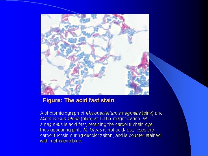 Figure: The acid fast stain A photomicrograph of Mycobacterium smegmatis (pink) and Micrococcus luteus