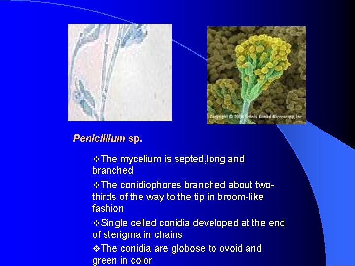 Penicillium sp. v. The mycelium is septed, long and branched v. The conidiophores branched