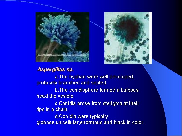 Aspergillus sp. a. The hyphae were well developed, profusely branched and septed. b. The