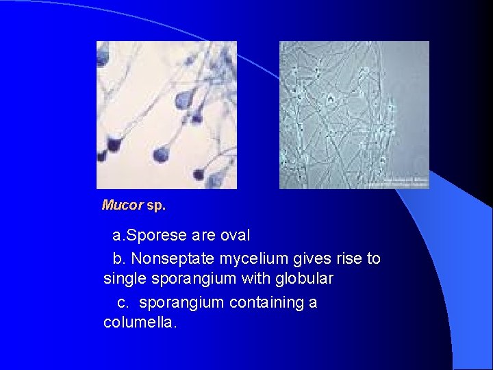 Mucor sp. a. Sporese are oval b. Nonseptate mycelium gives rise to single sporangium