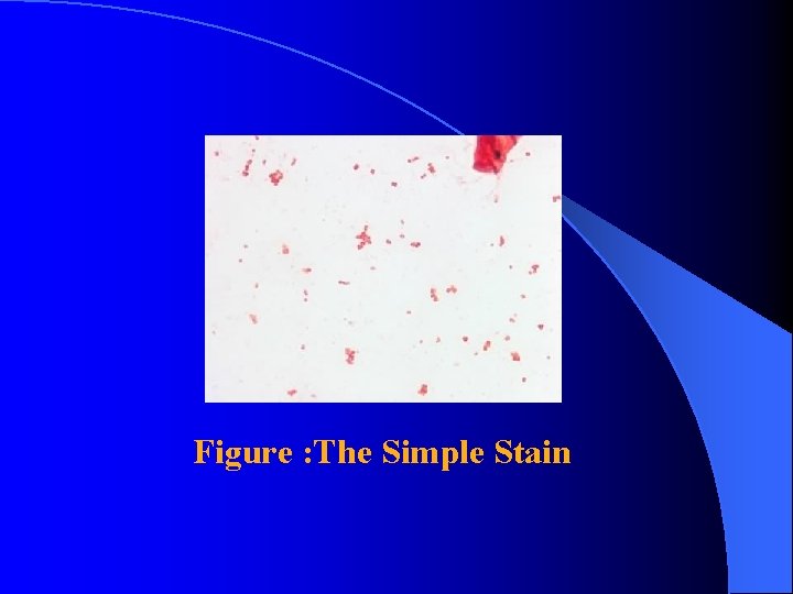 Figure : The Simple Stain 