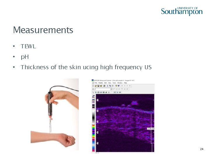 Measurements • TEWL • p. H • Thickness of the skin ucing high frequency