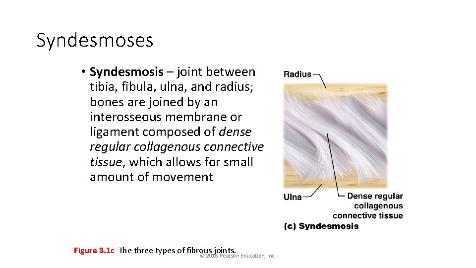 Syndesmoses • Syndesmosis – joint between tibia, fibula, ulna, and radius; bones are joined