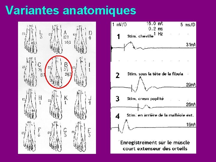 Variantes anatomiques 