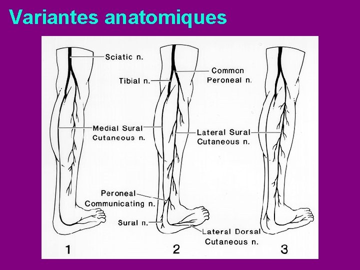 Variantes anatomiques 