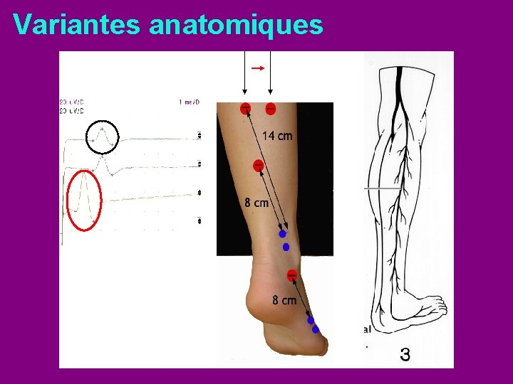 Variantes anatomiques 