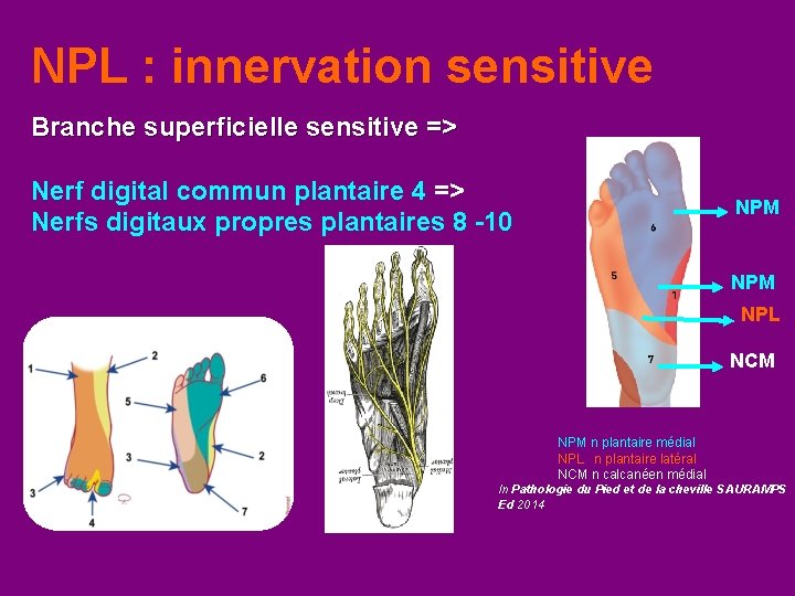 NPL : innervation sensitive Branche superficielle sensitive => Nerf digital commun plantaire 4 =>