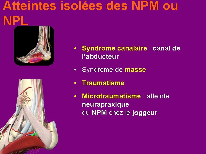 Atteintes isolées des NPM ou NPL • Syndrome canalaire : canal de l’abducteur •