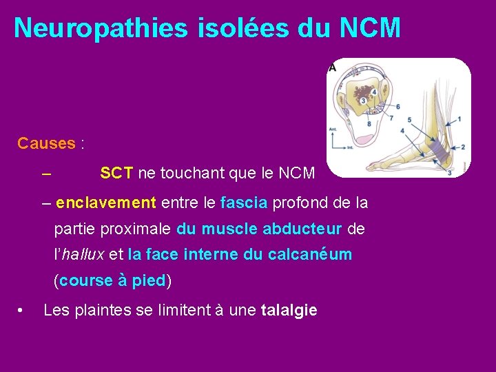 Neuropathies isolées du NCM Causes : – SCT ne touchant que le NCM –