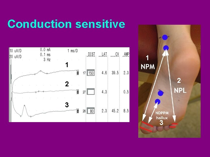 Conduction sensitive 1 1 2 2 3 3 