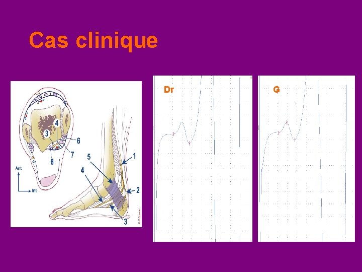 Cas clinique Dr G 