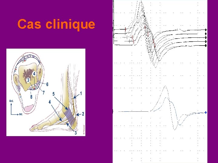 Cas clinique 