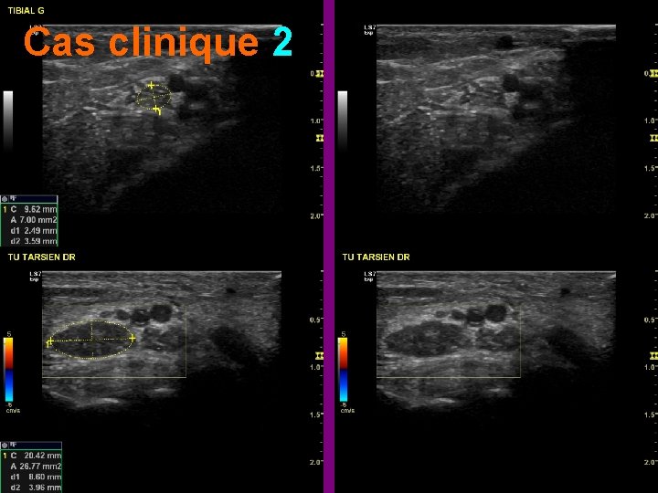 Cas clinique 2 