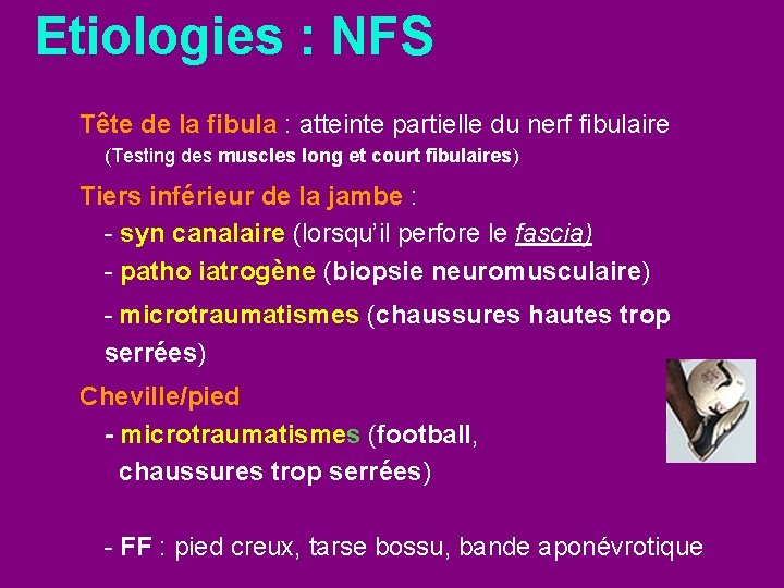 Etiologies : NFS Tête de la fibula : atteinte partielle du nerf fibulaire (Testing