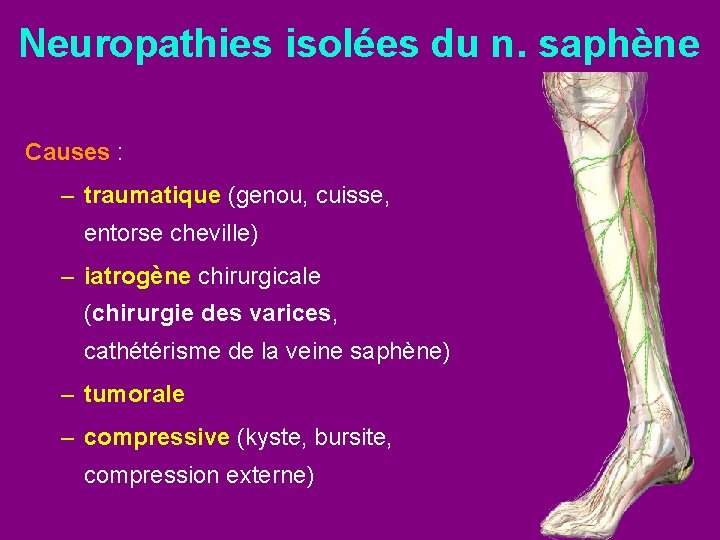 Neuropathies isolées du n. saphène Causes : – traumatique (genou, cuisse, entorse cheville) –