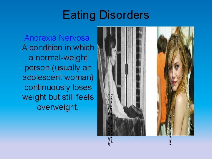 Eating Disorders Lisa O’Connor/ Zuma/ Corbis Reprinted by permission of The New England Journal