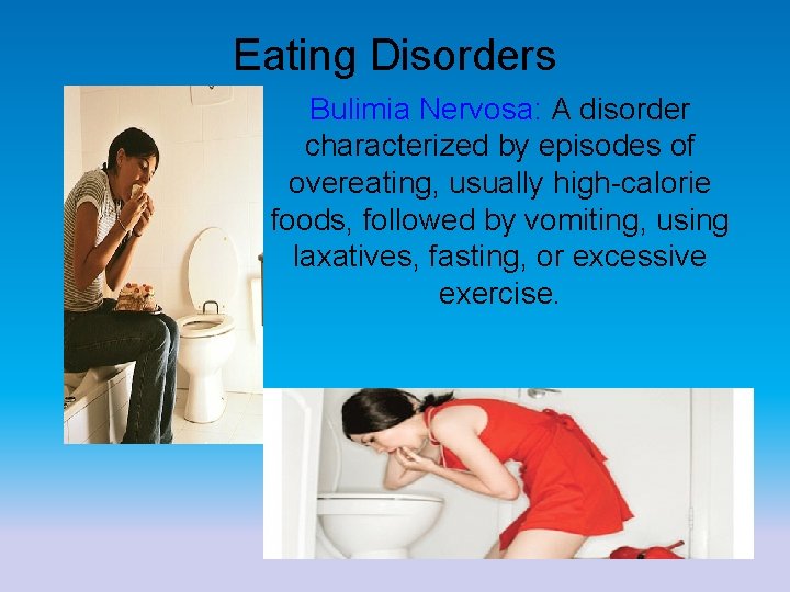 Eating Disorders Bulimia Nervosa: A disorder characterized by episodes of overeating, usually high-calorie foods,
