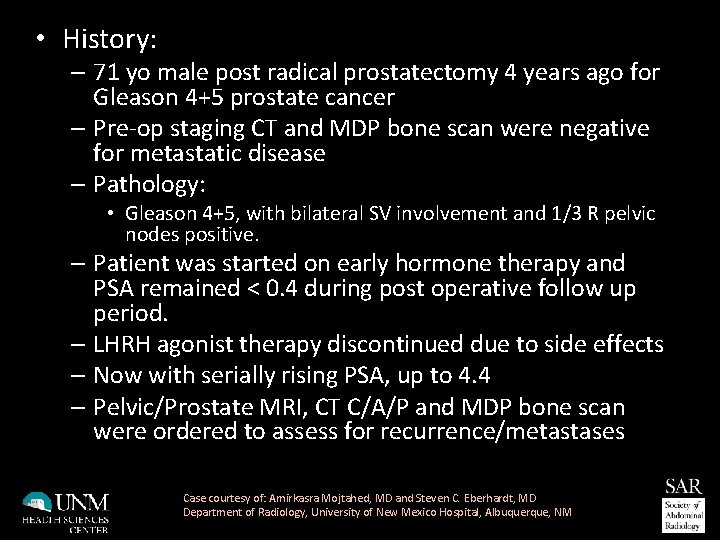  • History: – 71 yo male post radical prostatectomy 4 years ago for