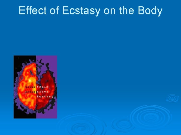 Effect of Ecstasy on the Body 