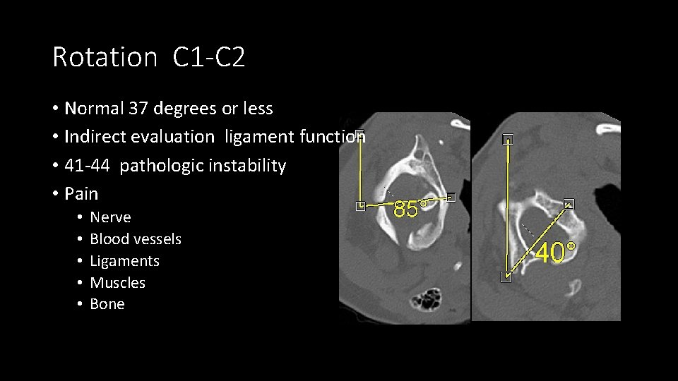 Rotation C 1 -C 2 • Normal 37 degrees or less • Indirect evaluation