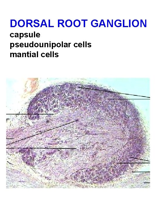 DORSAL ROOT GANGLION capsule pseudounipolar cells mantial cells 